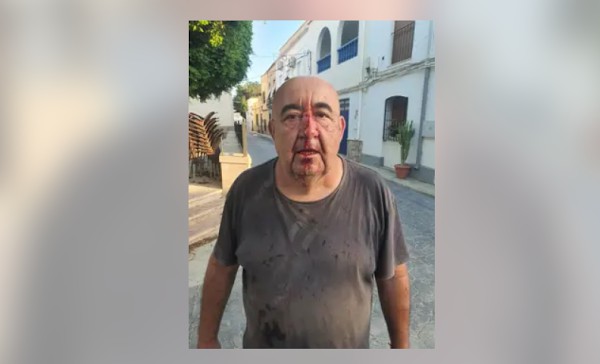 Concejal de Alsodux recibe orden de alejamiento tras agresión con piedra