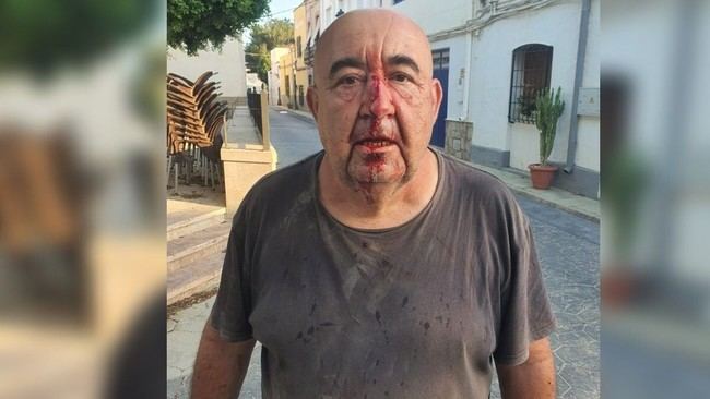 Agreden a concejal de Almería y le rompen la nariz con una piedra