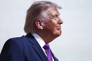 Médico de Trump advierte: debe perder peso a pesar de tener un corazón joven