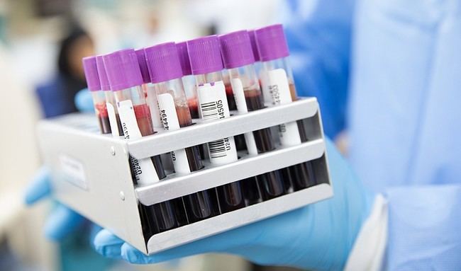 Almería impulsa la donación de sangre para investigar la salud cardiovascular femenina