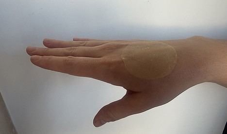 Innovador vendaje de paja y hongo asiático desarrollado en Córdoba acelera la cicatrización